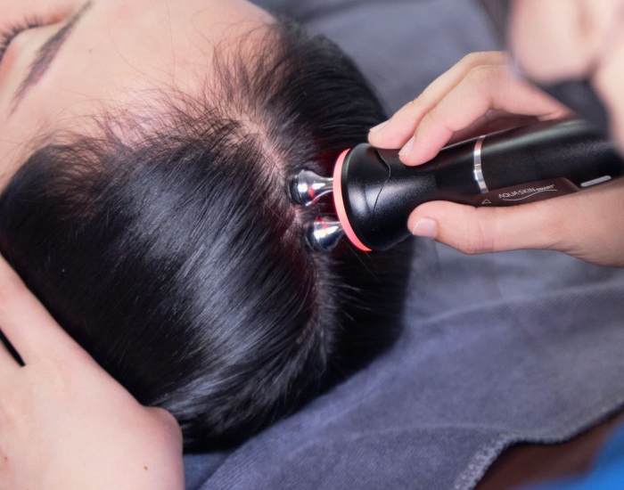 Kì Đầu Rụng Tóc ( 90 Phút)